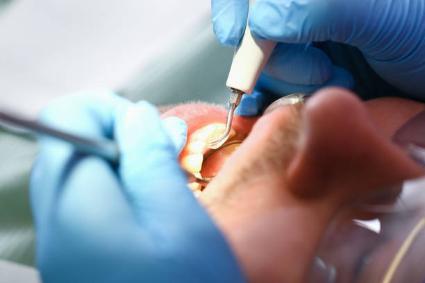 Best Emergency Dentist Near Me  in Carlinvle, IL