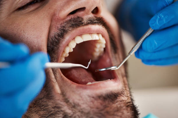 Best Tooth Pain Emergency Relief  in Carlinvle, IL